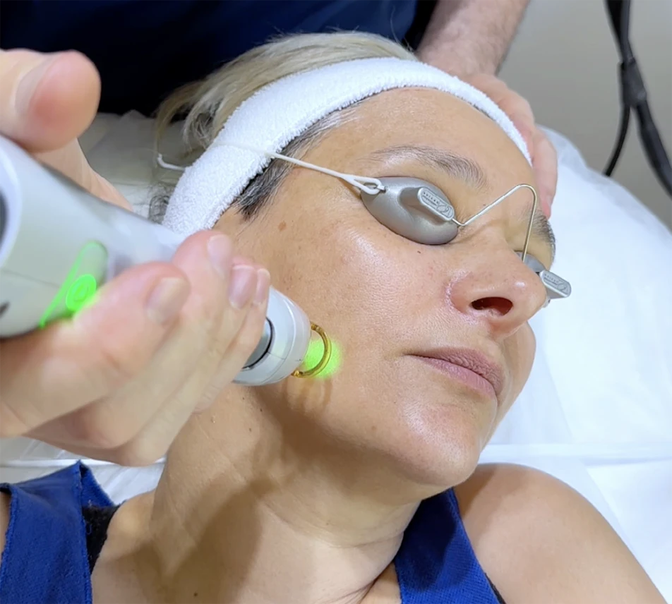 Laser Candela Alexandrita 755 Gentle Max Pro​